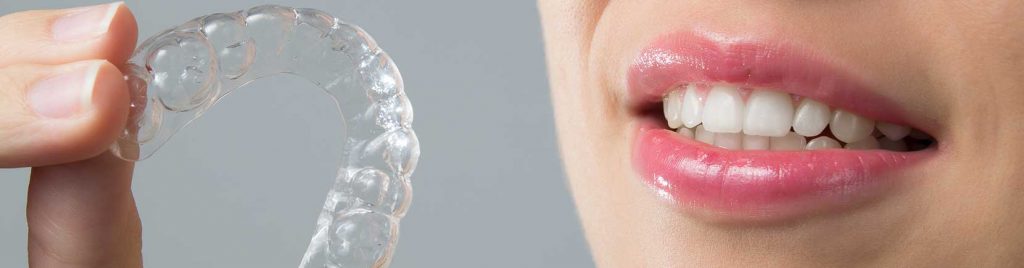 invisalign