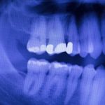 Chesapeake VA Family Dentist