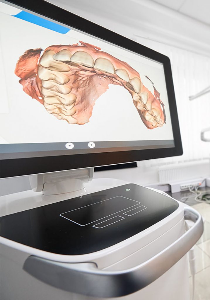 3D Dental Scanning